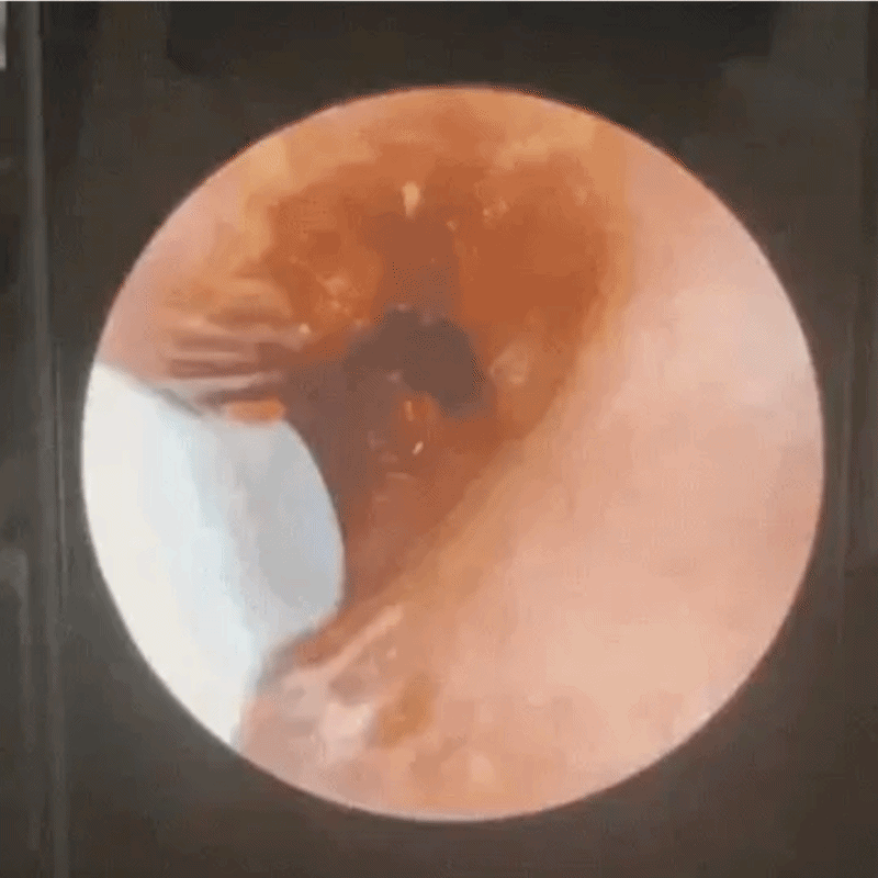 EarScope PRO